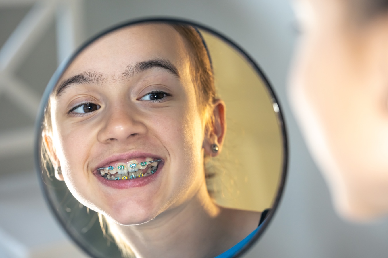 Braces for Teens